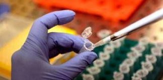 Focolaio di Legionella a Milano: 1 morto e 11 casi in zona San Siro: in corso le indagini di Ats