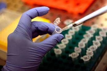 Focolaio di Legionella a Milano: 1 morto e 11 casi in zona San Siro: in corso le indagini di Ats