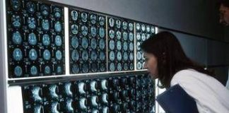 Cancro, 4 sintomi ‘insoliti’ che bisogna conoscere: parola di oncologo